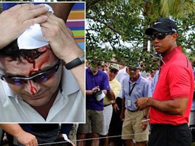 Duh, Kepala Seorang Penonton Bocor Terkena Pukulan Bola Tiger Woods!